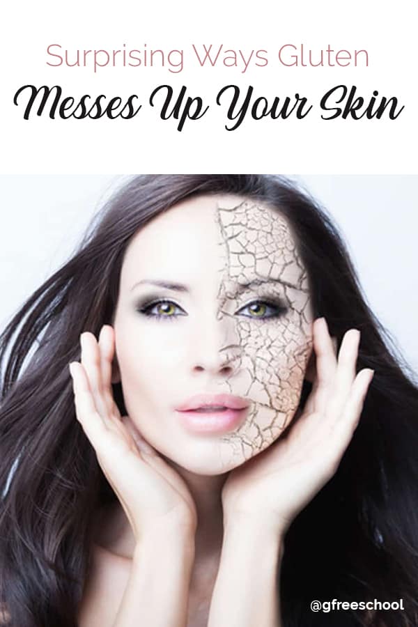 Surprising Ways Gluten Messes Up Your Skin