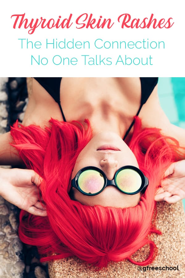 Thyroid Skin Rashes: The Hidden Connection No One Talks About
