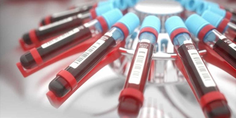 Blood test for thyroid hormones